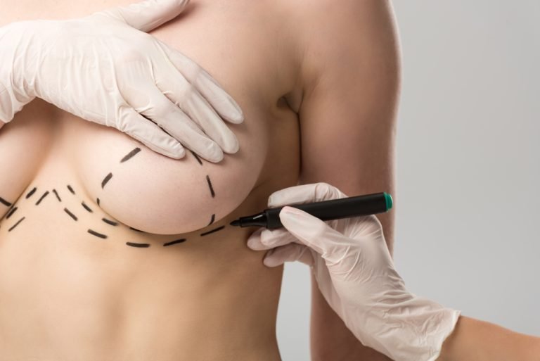 cropped view of plastic surgeon in latex gloves making marks on breast isolated on grey