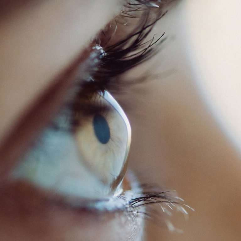 ceratocone editor (1)