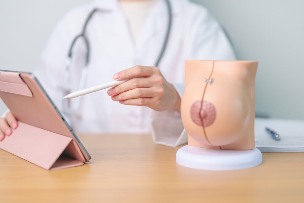 Doctor with Breast Anatomy model. Breast Augmentation Surgery, O