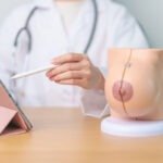 Ministério da Educação aprimora a residência médica em Mastologia