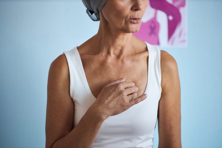 Middle Aged Woman Touching Chest While Undergoing Cancer Treatment