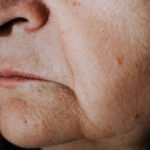 Por que depois dos 40, o rosto muda mais rápido? Entenda o que está por trás da flacidez facial